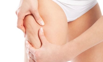 Jakie zabiegi antycellulitowe są najlepsze?