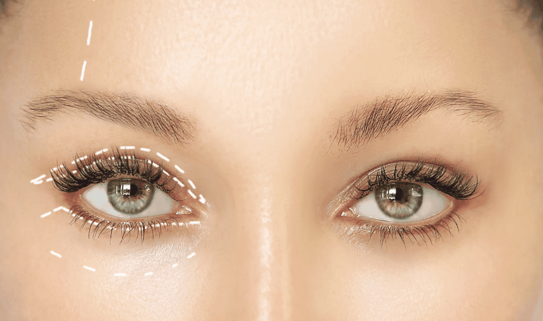 Blefaroplatyka- kosmetyczny zabieg powiek