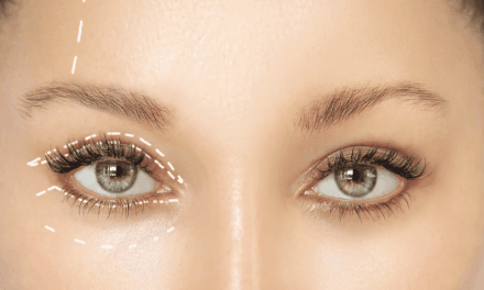 Blefaroplatyka- kosmetyczny zabieg powiek