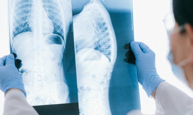 Rezonans magnetyczny kręgosłupa – kiedy ból pleców to sygnał ostrzegawczy