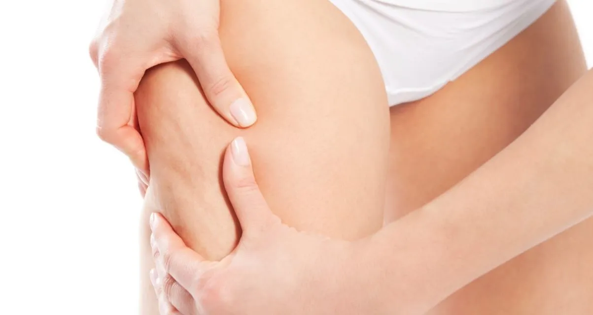 Jakie zabiegi antycellulitowe są najlepsze?