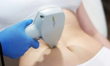 Skuteczne usuwanie rozstępów w Katowicach